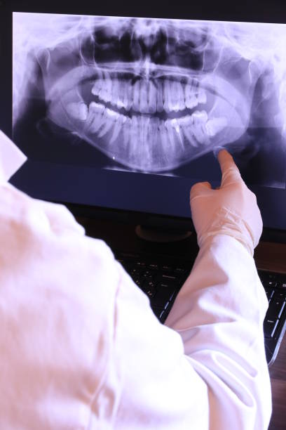Best Emergency Root Canal Treatment in Ludlow, KY